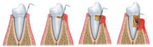 Parodontoloogia