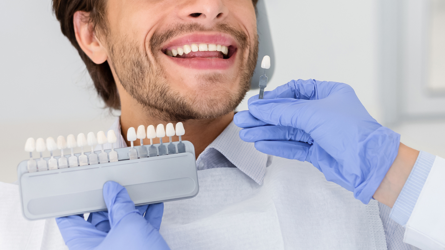 Valgemad hambad: kuidas hoida hambaid valgetena